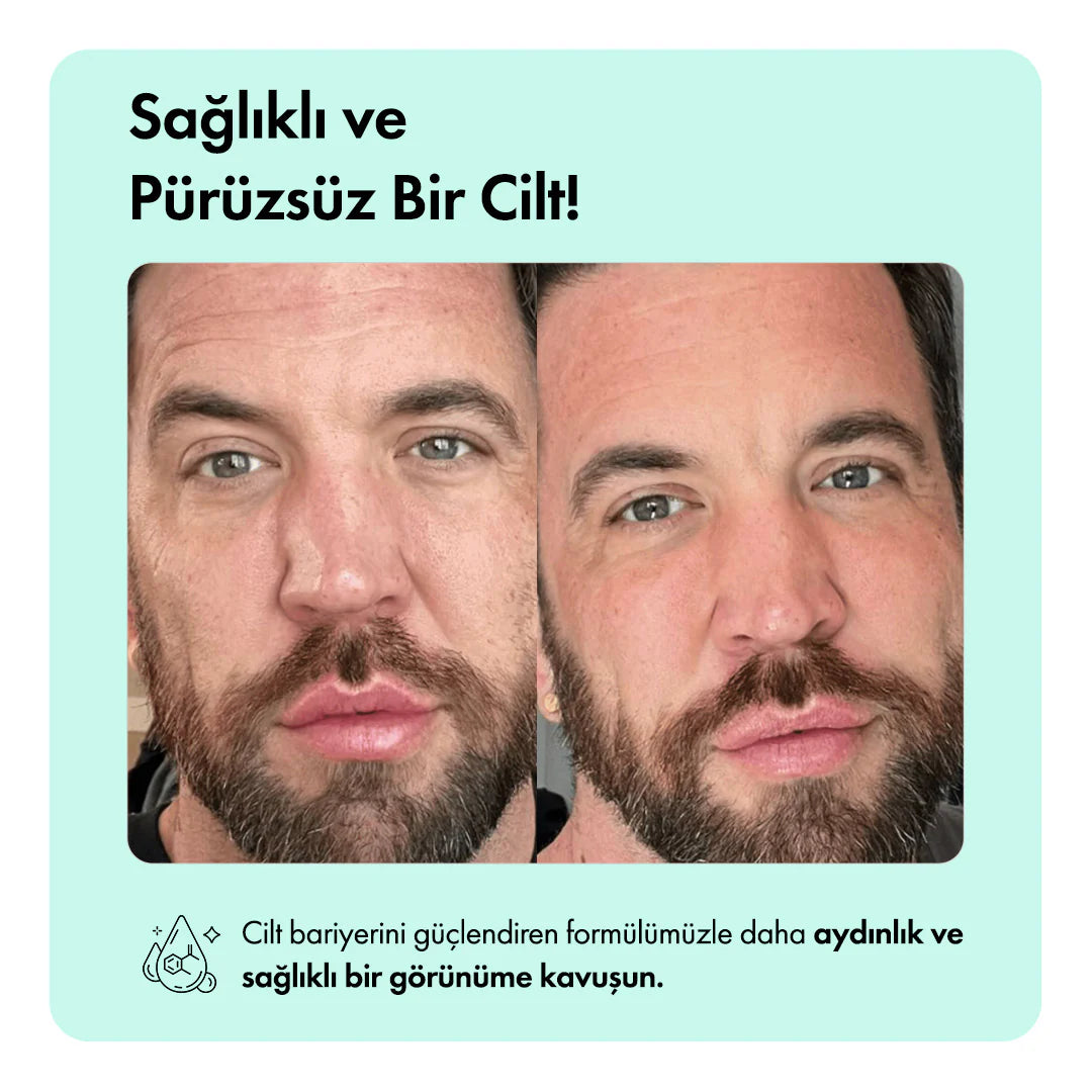 Kaplan Otu Özlü Canlandırıcı, Nemlendirici ve Acne Karşıtı Temizleme Barı 85g 3oz