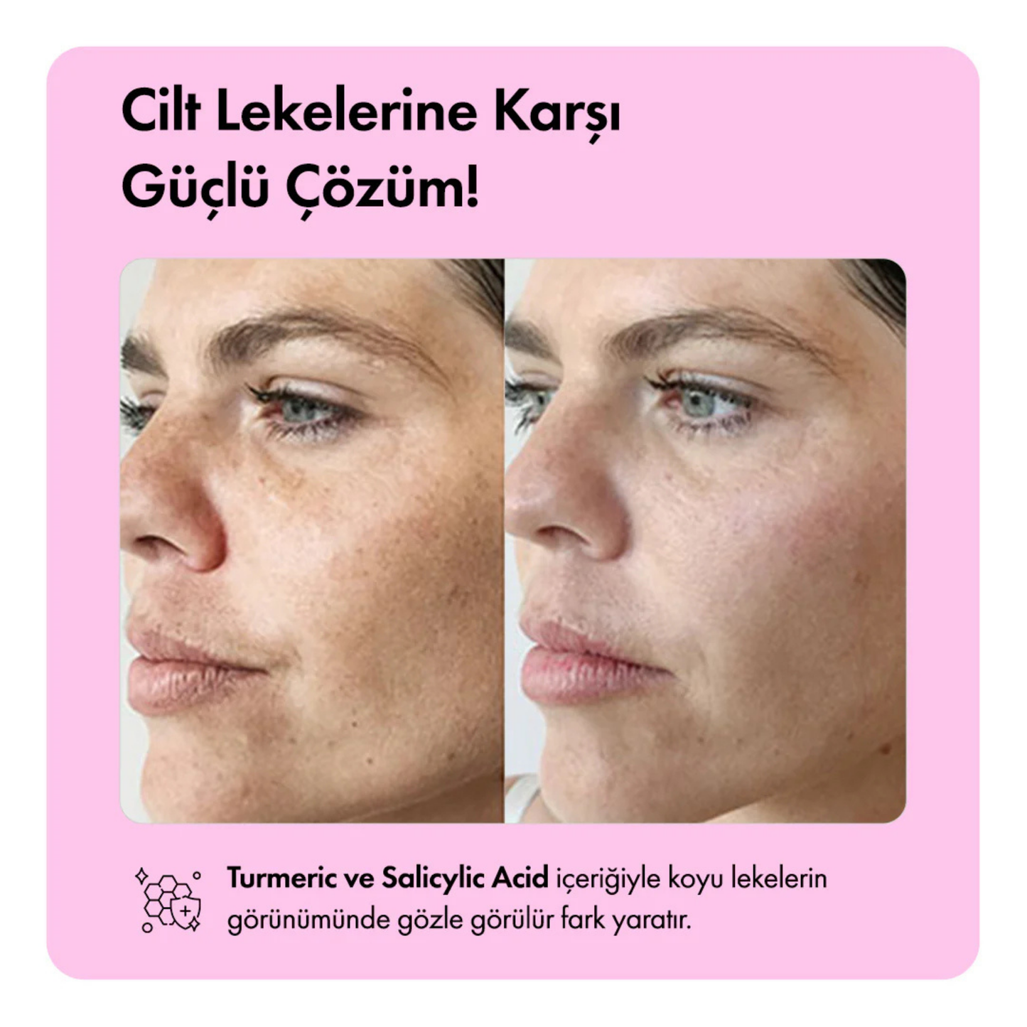 Kore Usulü Cilt Aydınlatıcı Temizleme Barı