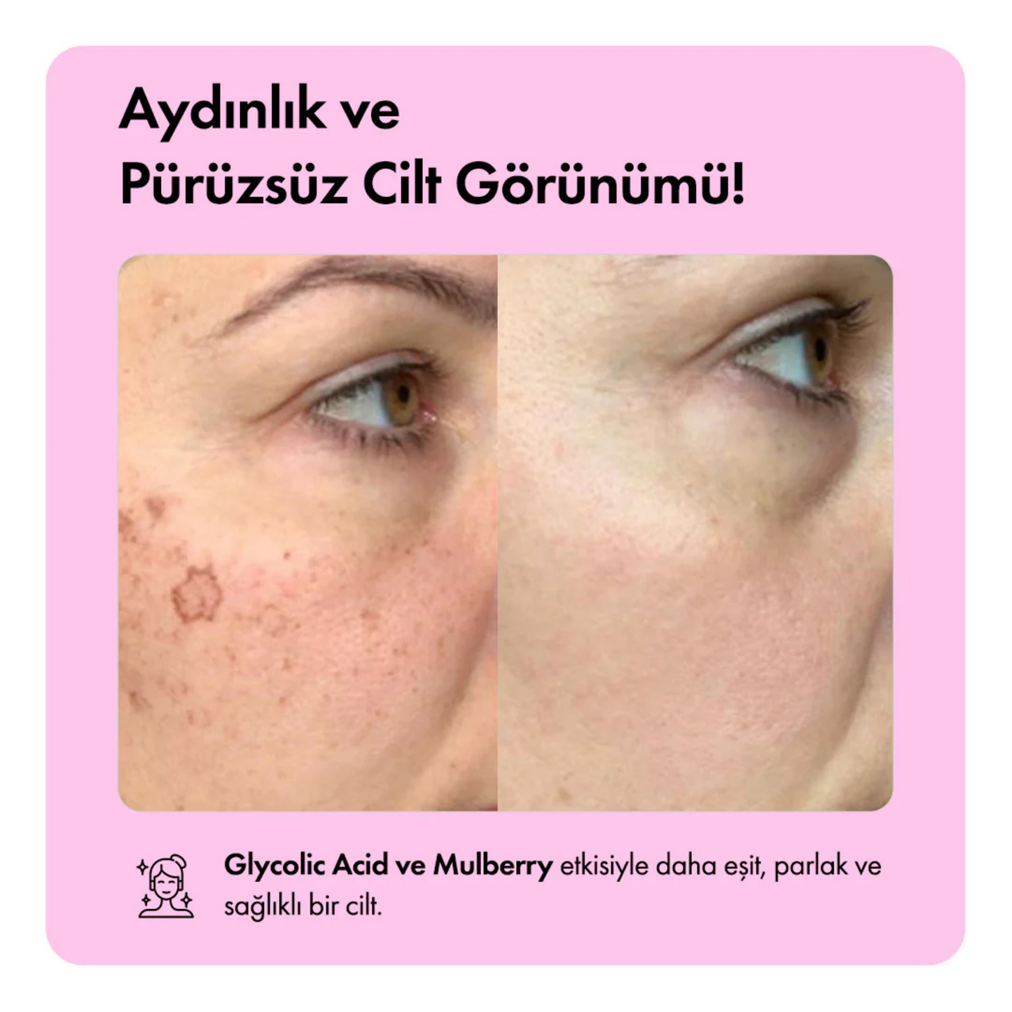 Kore Usulü Cilt Aydınlatıcı Temizleme Barı