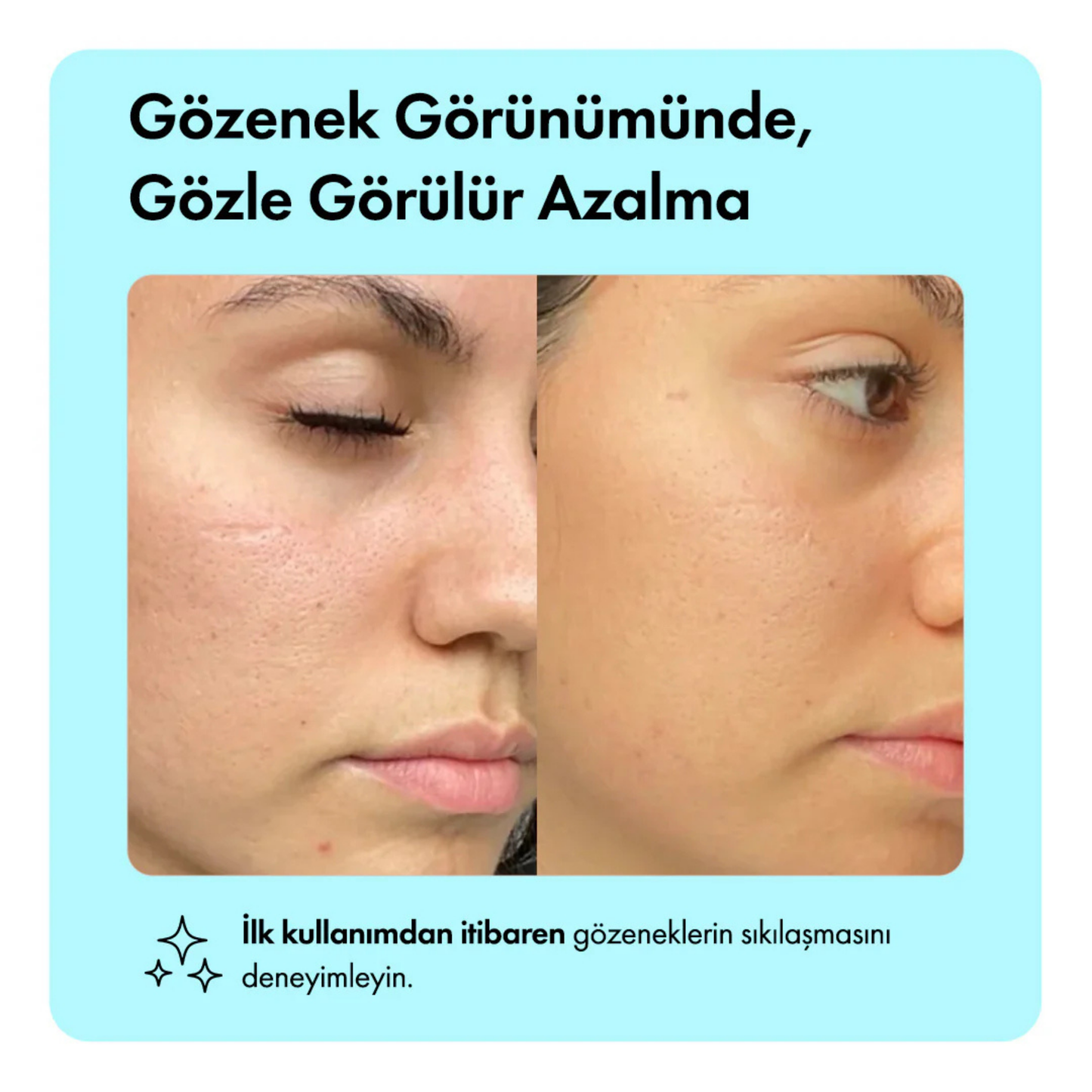 Nar Çekirdeği Yağlı Canlandırıcı, Nemlendirici ve Gözenek Sıkılaştırıcı Yüz Serumu 30 ml