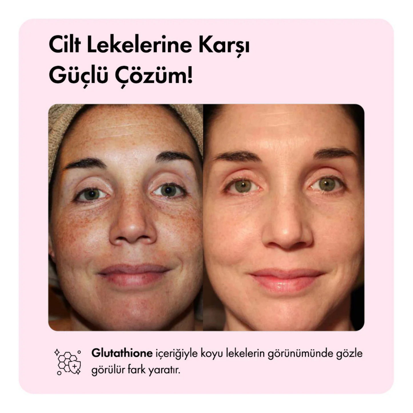 Pirinç Kepeği Yağlı Leke Karşıtı & Cilt Tonu Eşitleyen Aydınlatıcı Cildi Parlatan Yüz Serumu 30 ml