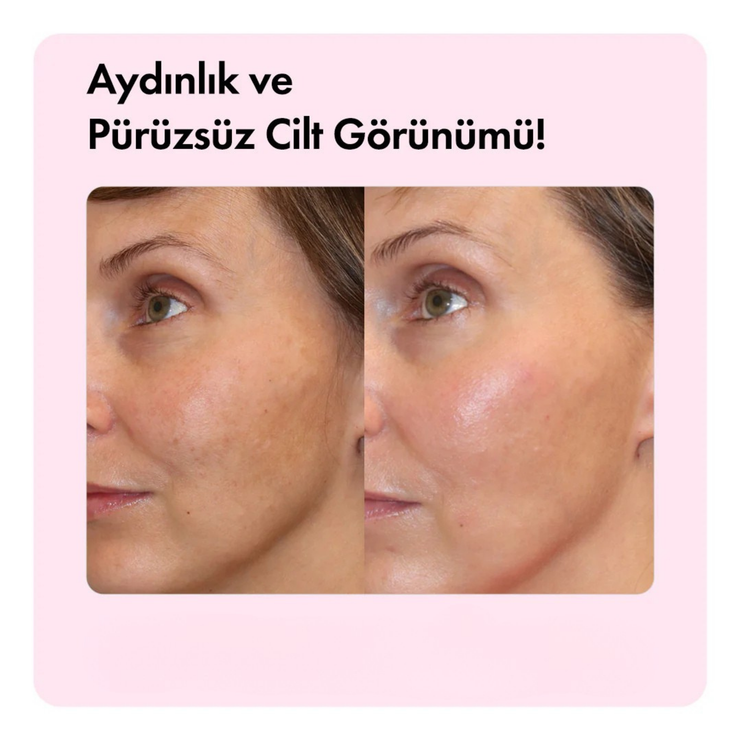 Pirinç Kepeği Yağlı Leke Karşıtı & Cilt Tonu Eşitleyen Aydınlatıcı Cildi Parlatan Yüz Serumu 30 ml