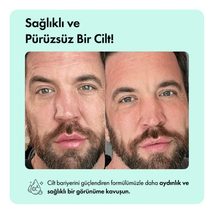 Kaplan Otu Özlü Canlandırıcı, Nemlendirici ve Acne Karşıtı Temizleme Barı 85g 3oz