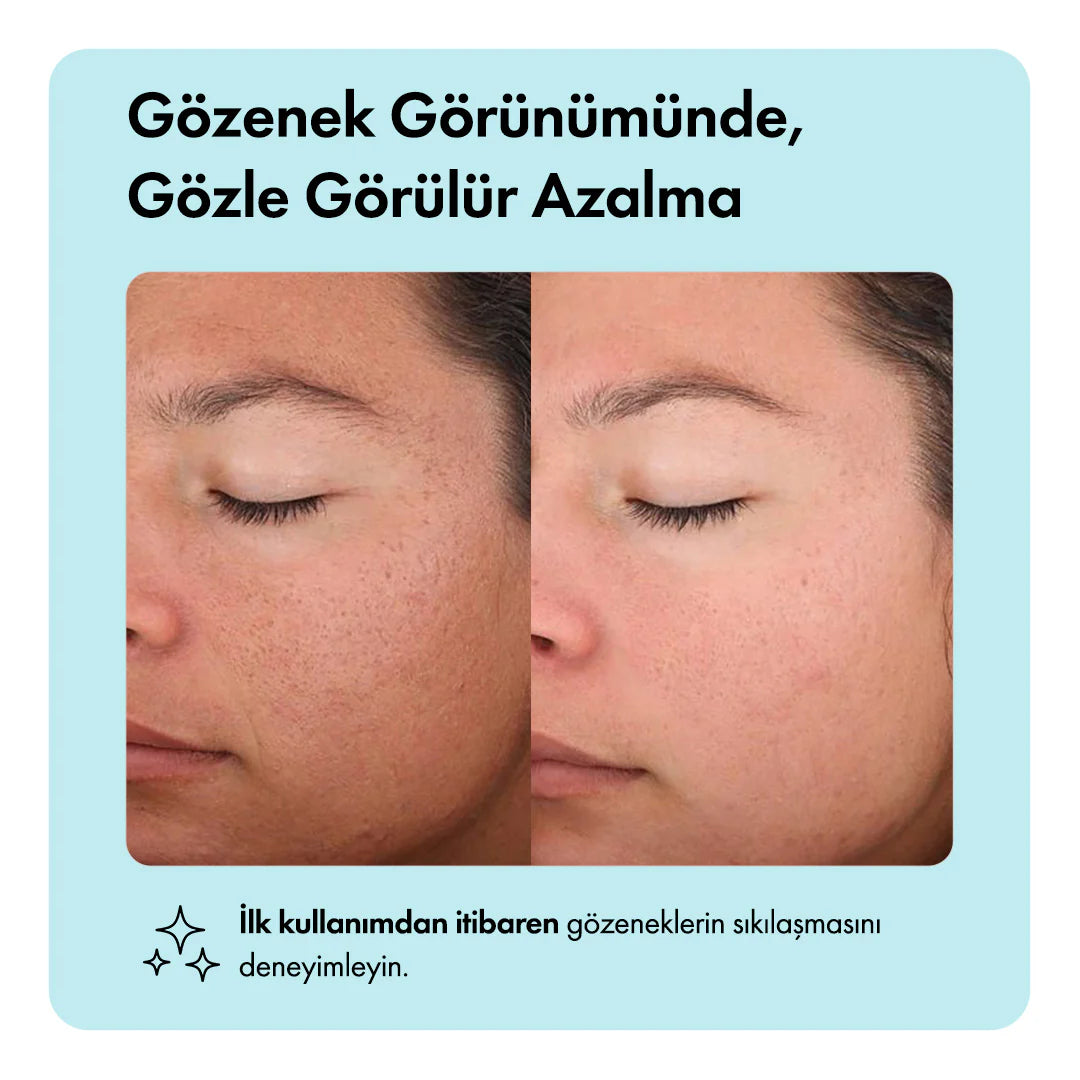 Kayısı Çekirdeği Yağlı Canlandırıcı, Nemlendirici ve Gözenek Sıkılaştırıcı Temizleme Barı 85g 3oz