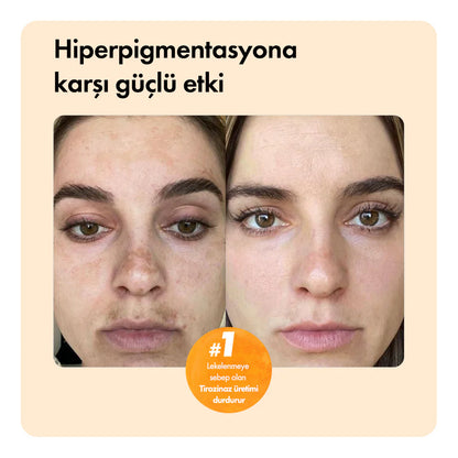 Kojik Asit & Zerdeçal Leke Karşıtı & Cilt Tonu Eşitleyen Cilt Aydınlatıcı Temizleme Barı 85g 3oz