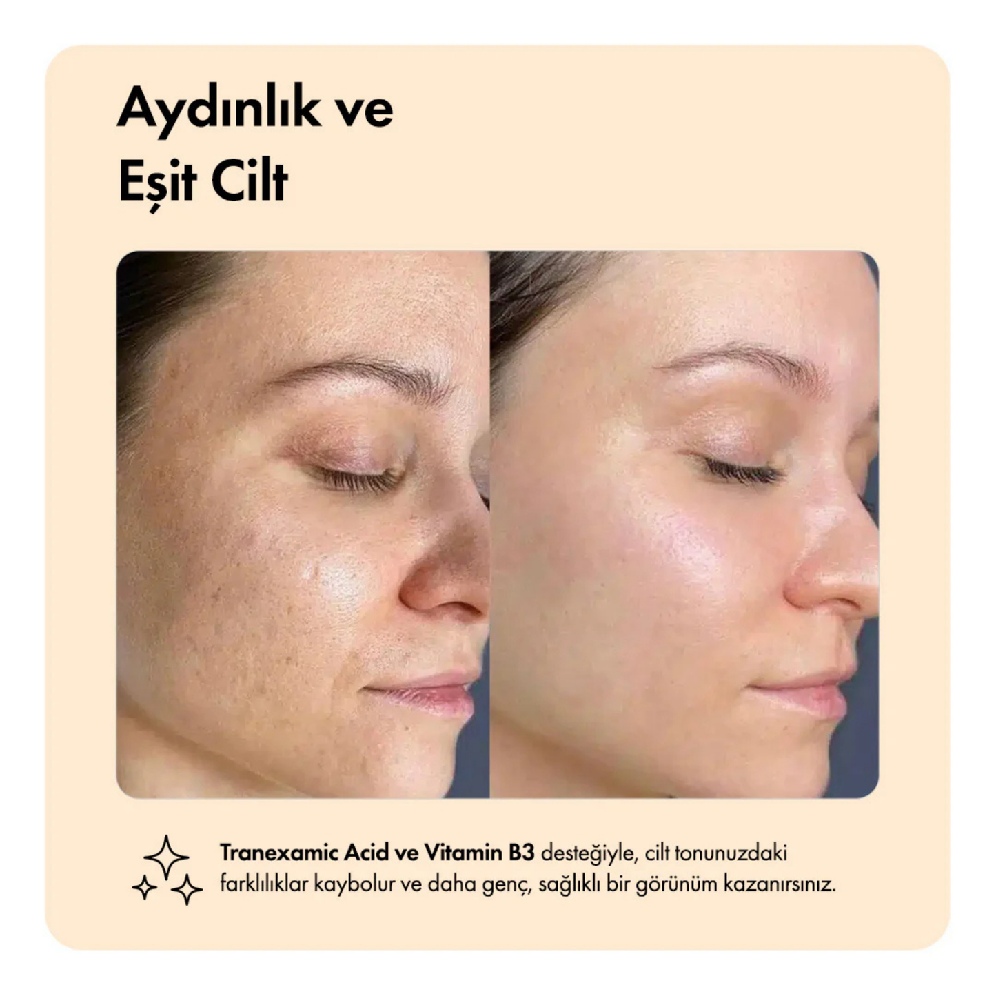 Kojik Asit & Zerdeçal Leke Karşıtı & Cilt Tonu Eşitleyen Aydınlatıcı Cildi Parlatan Yüz Serumu 30 ml