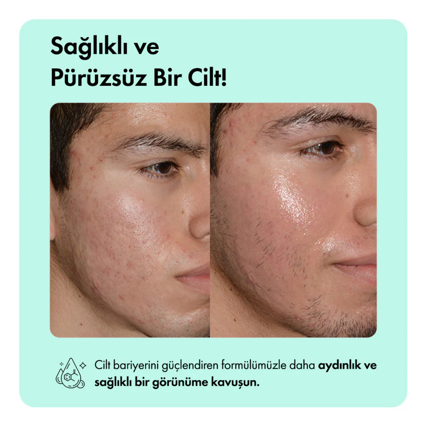 Kaplan Otu Özlü Canlandırıcı, Nemlendirici ve Acne Karşıtı Yüz Serumu 30 ml