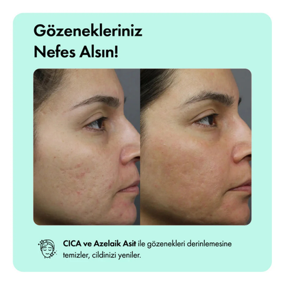 Kaplan Otu Özlü Canlandırıcı, Nemlendirici ve Acne Karşıtı Yüz Serumu 30 ml