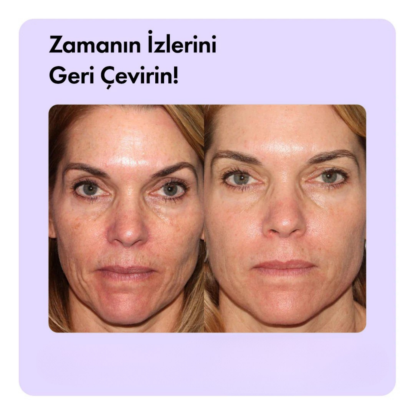 Aleovera & Peptit Yaşlanma, Kaz Ayakları & Kırışıklık Karşıtı Yüz Serumu 30 ml