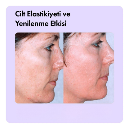 Aleovera & Peptit Yaşlanma, Kaz Ayakları & Kırışıklık Karşıtı Yüz Serumu 30 ml
