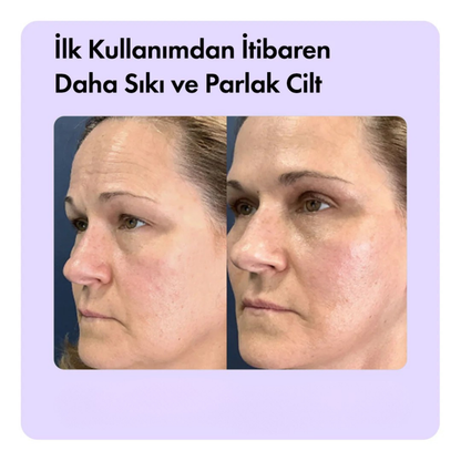Aleovera & Peptit Yaşlanma, Kaz Ayakları & Kırışıklık Karşıtı Yüz Serumu 30 ml