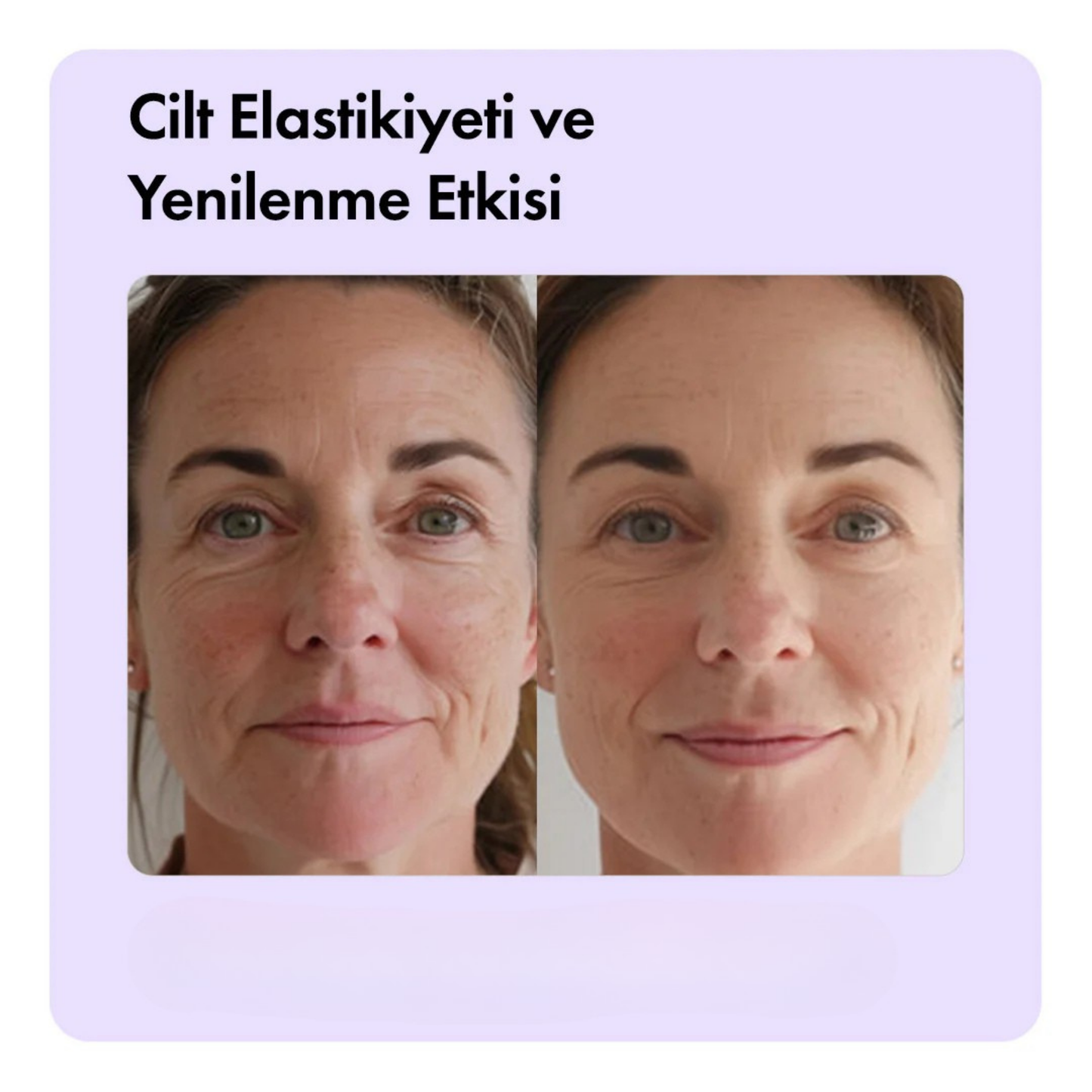 Aleovera & Peptit Yaşlanma, Kaz Ayakları & Kırışıklık Karşıtı Temizleme Barı 85g 3oz