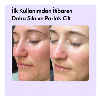 Aleovera & Peptit Yaşlanma, Kaz Ayakları & Kırışıklık Karşıtı Temizleme Barı 85g 3oz
